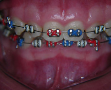 Orthodontist Zurich